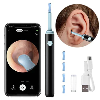 NEXOVA™   - PROFESSIONAL EAR WAX REMOVAL TOOL
