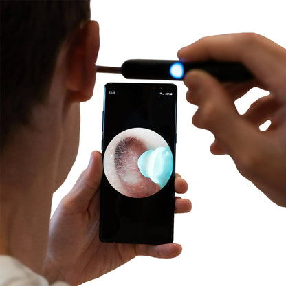 NEXOVA™   - PROFESSIONAL EAR WAX REMOVAL TOOL
