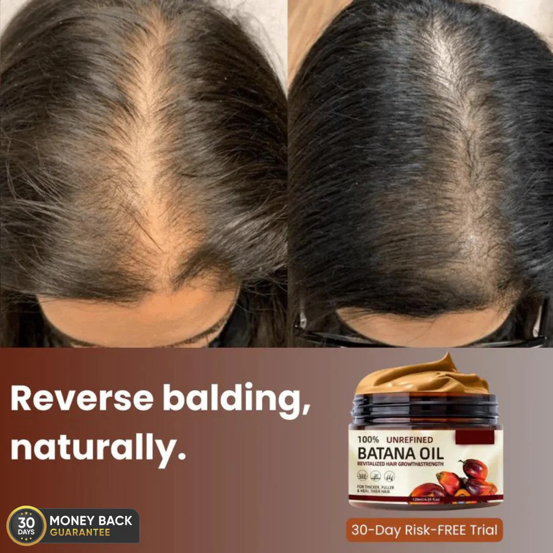 NEXOVA™  - 100% UNREFINED BATANA OIL (Buy 1 Get 1 Free)